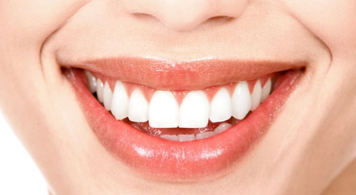 Diş Beyazlatma Neden Önemlidir